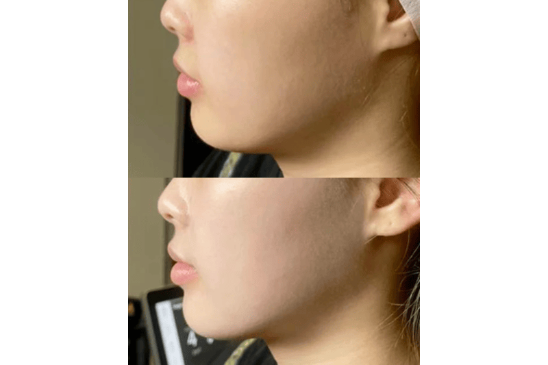 Hello Hydration Med Spa